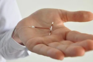 Paragard IUD Medical Records