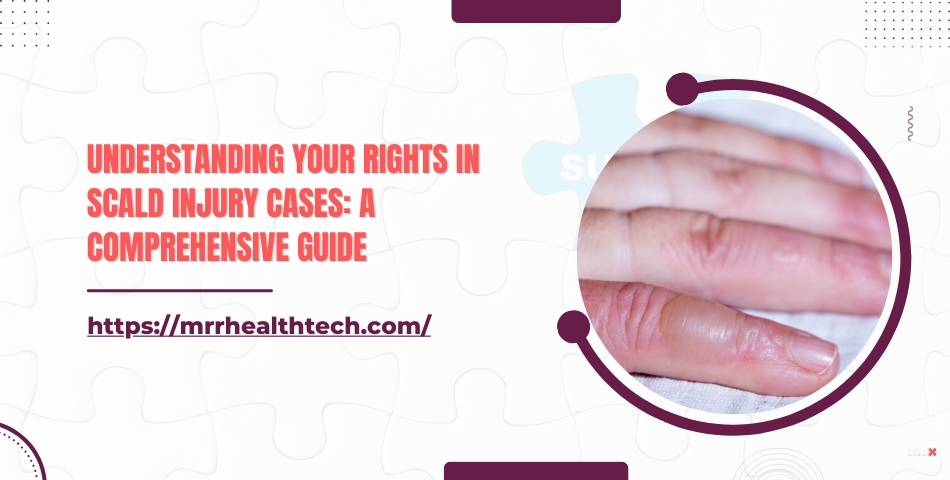 Understanding Your Rights in Scald Injury Cases A Comprehensive Guide