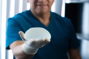 Allergan Breast Implant Lawsuit