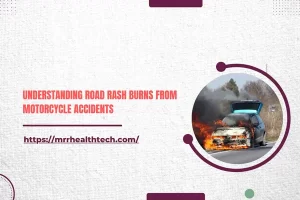 Understanding Road Rash Burns from Motorcycle Accidents
