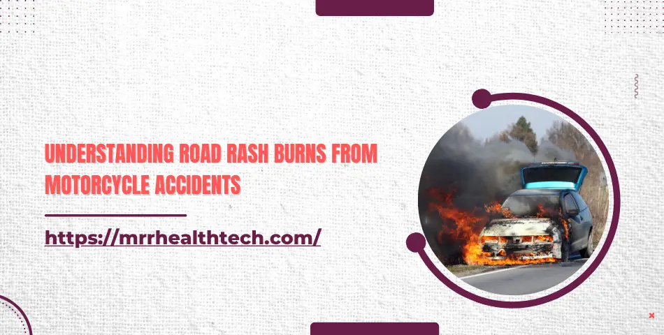 Understanding Road Rash Burns from Motorcycle Accidents