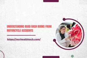 Understanding Teen Driver Car Accidents: An Ultimate Guide for Attorneys