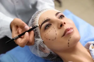 Cosmetic Surgery Compensation Claims